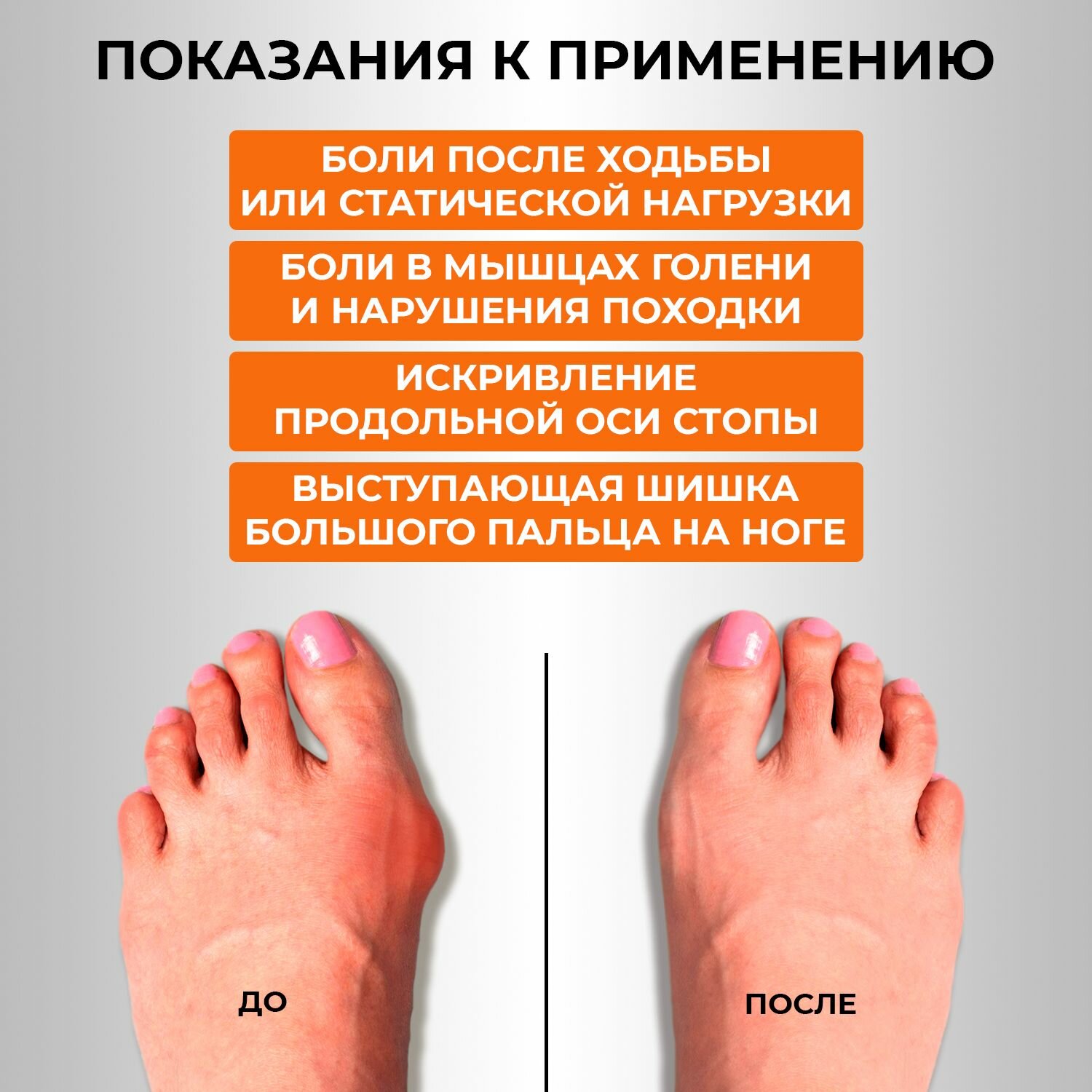 Гель Valgus Cure для устранения вальгусной деформации, 1 упаковка — фото 1