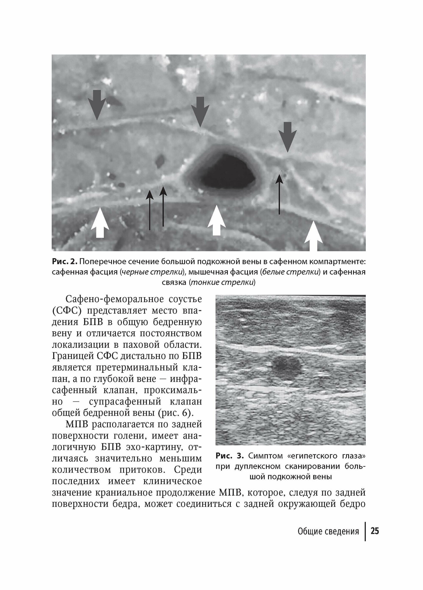 Справочник хирурга-флеболога (Ширинбек О.) - фото №4