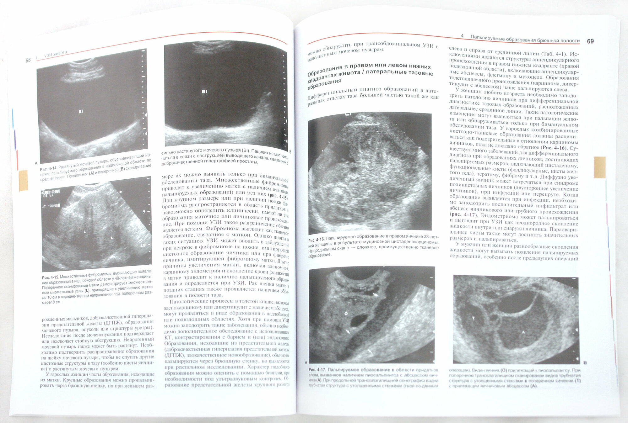 Ультразвуковая диагностика. Практическое решение клинических проблем. Том 1: УЗИ живота - фото №2