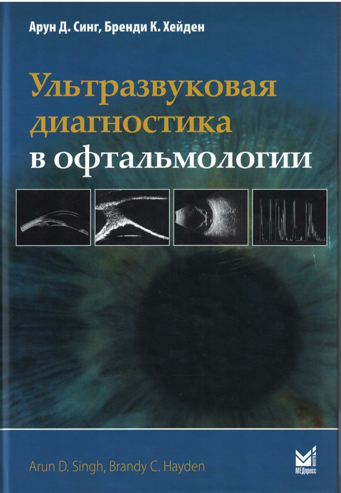 Ультразвуковая диагностика в офтальмологии