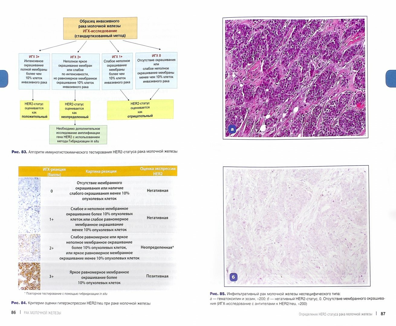 Рак молочной железы. Морфологическая диагностика и генетика. Руководство для врачей - фото №2