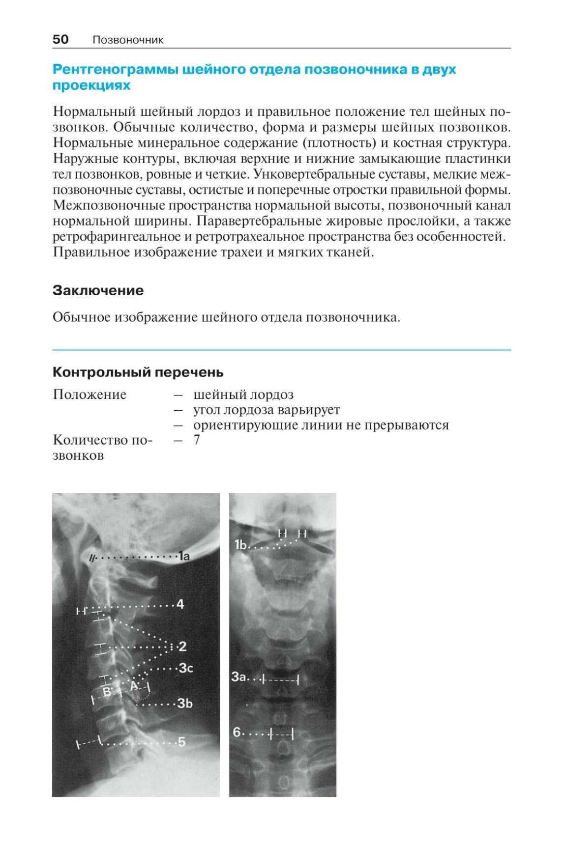 Норма при рентгенологических исследованиях / 3-е изд. - фото №10