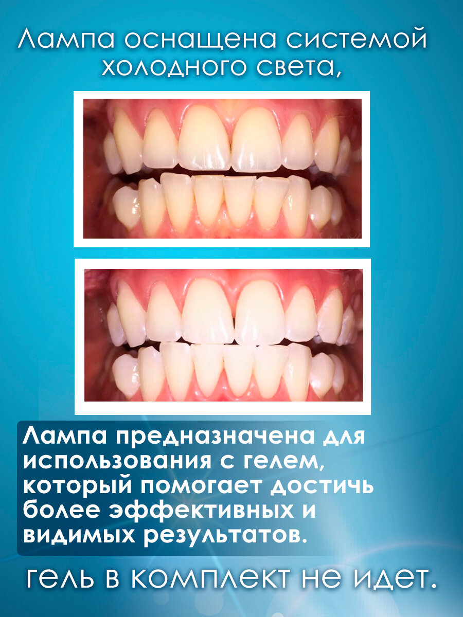 Средства Для Отбеливания Зубов Лампа для отбеливания зубов, для домашнего отбеливания зубов, электронная световая система отбеливания зубов