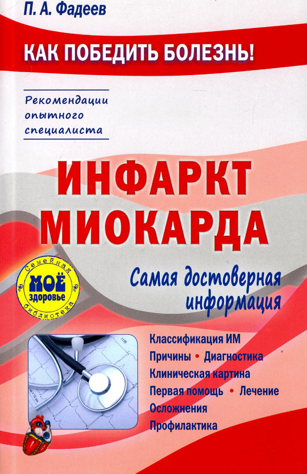 Инфаркт миокарда