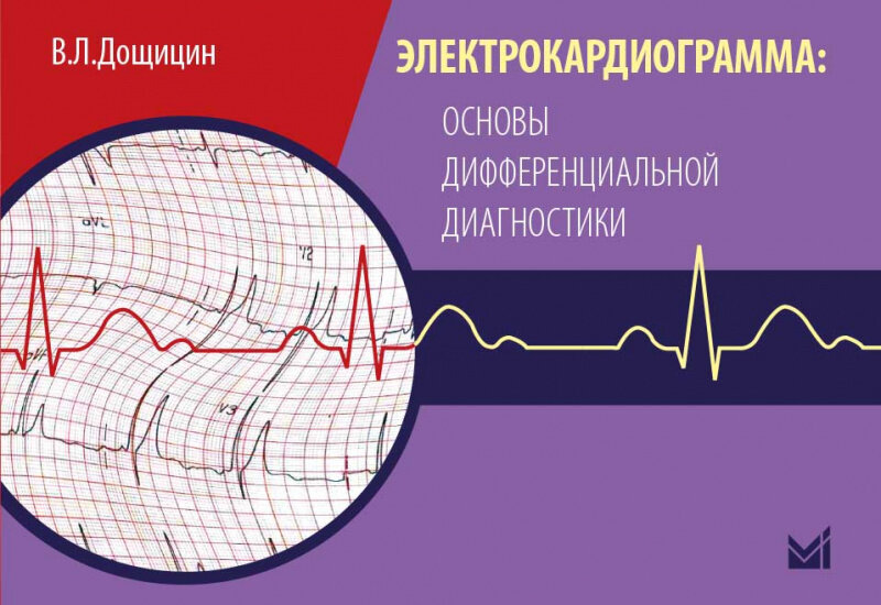 Электрокардиограмма: основы дифференциальной диагностики