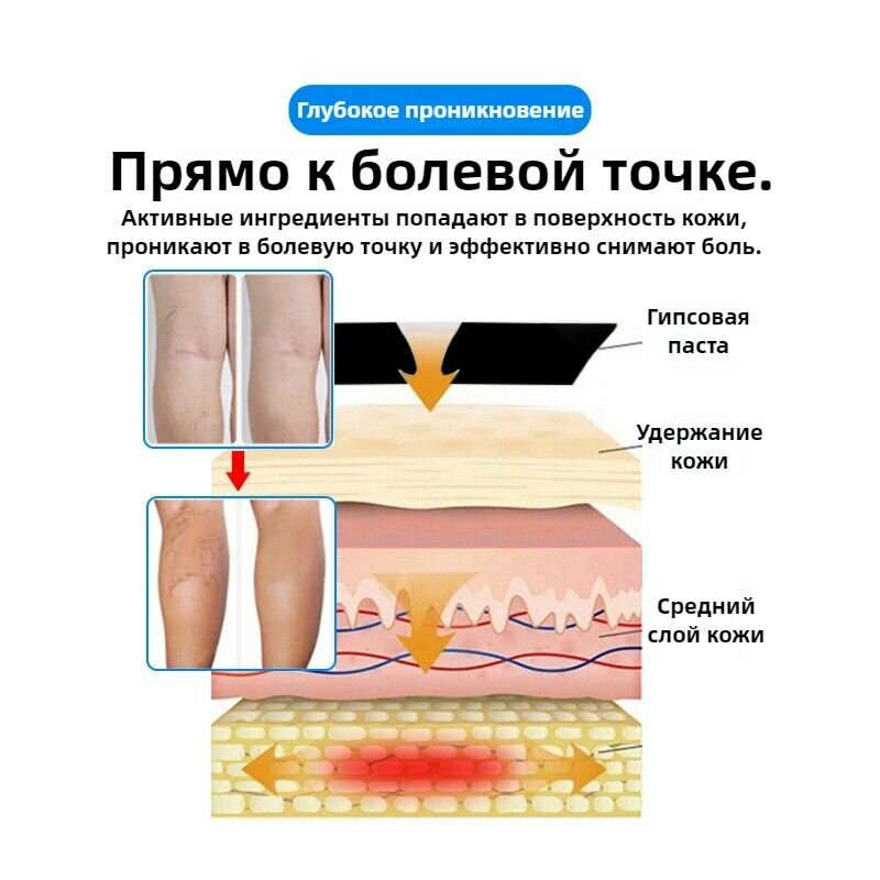 Изображение Пластыри от варикозного расширения вен и васкулита 6 шт От венозной недостаточности Для ног и коленей Обезболивающий Китай