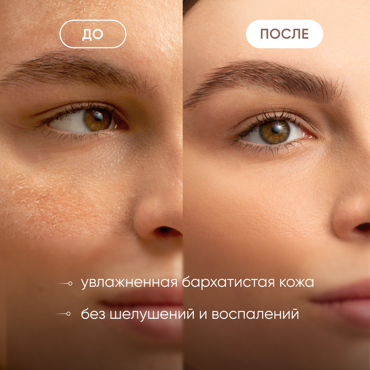 Увлажняющий спрей мист для лица успокаивающий / тоник для лица с гиалуроновой кислотой — фото 1