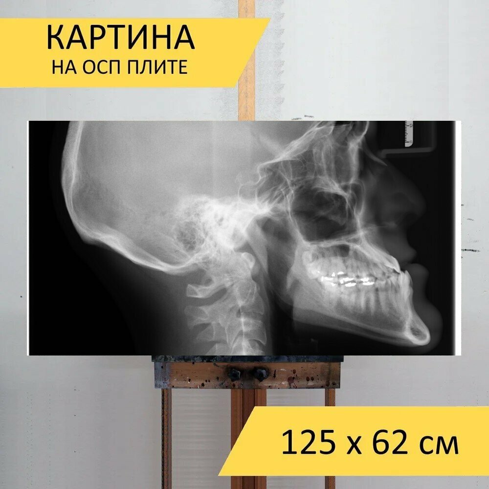 Картина на ОСП 125х62 см. "Рентгеновский рентгеновские радиология" горизонтальная для интерьера с креплениями