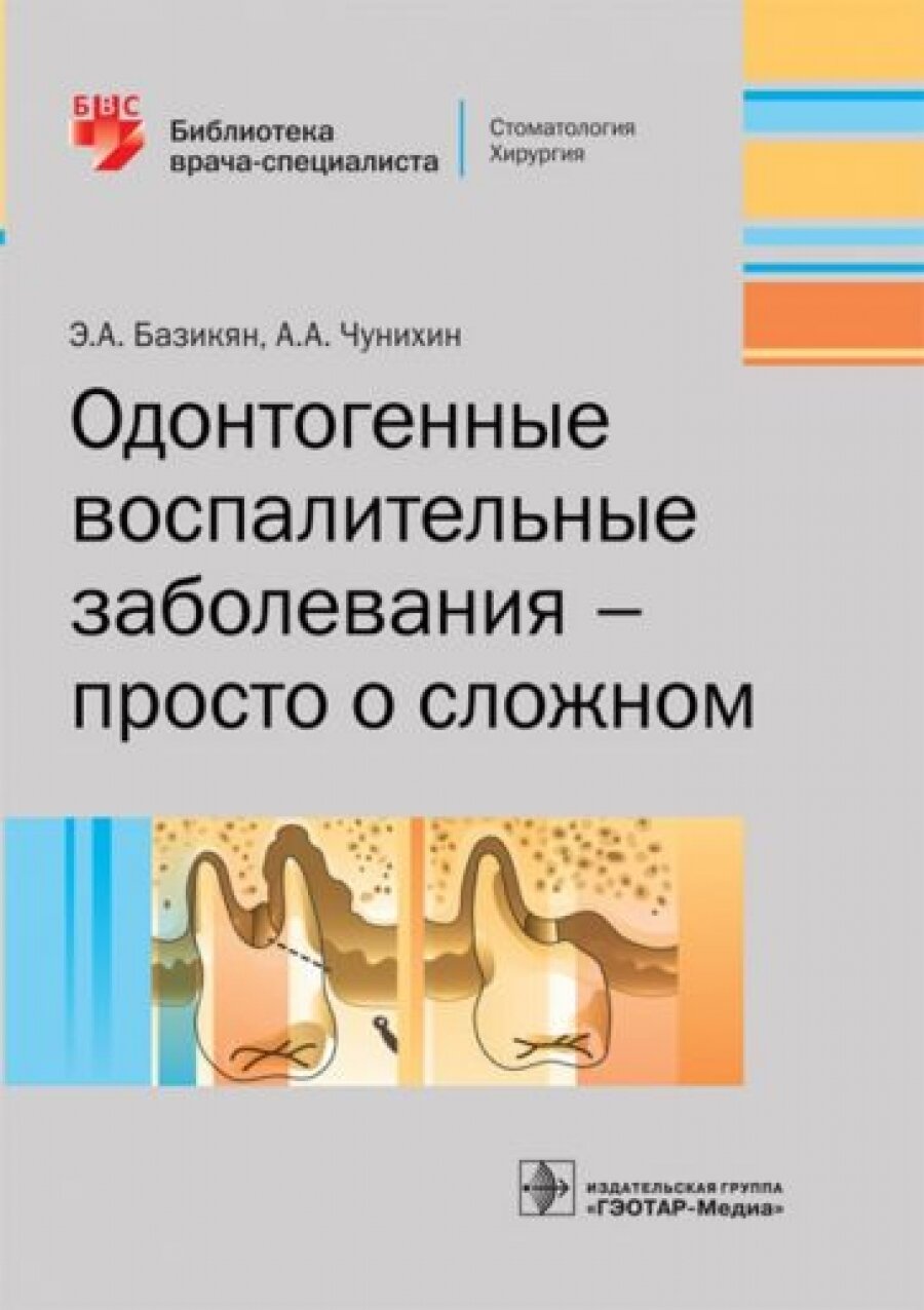 Одонтогенные воспалительные заболевания - просто о сложном - фото №8