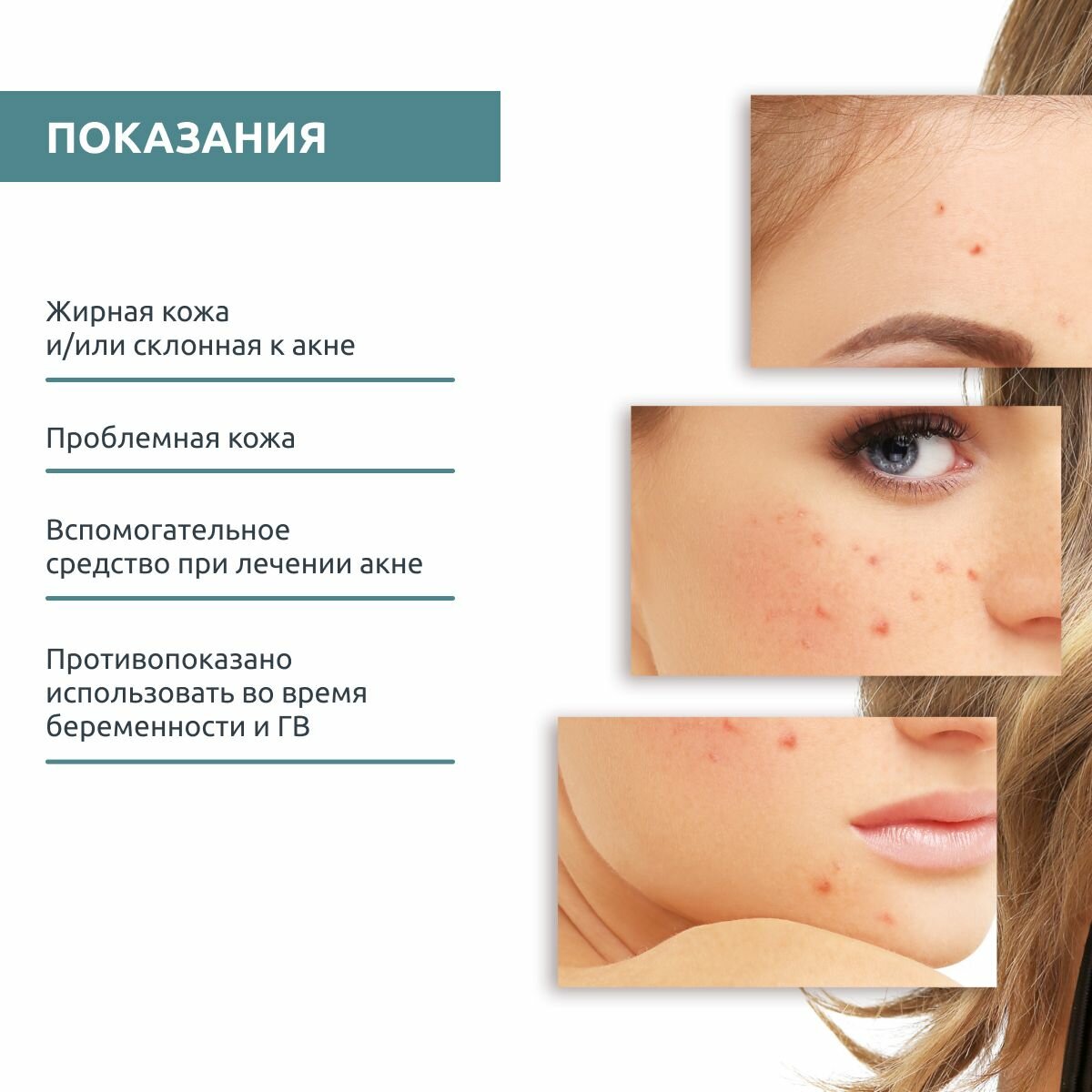 Sesderma Точечный корректор , 15 мл (Sesderma, ) - фото №11