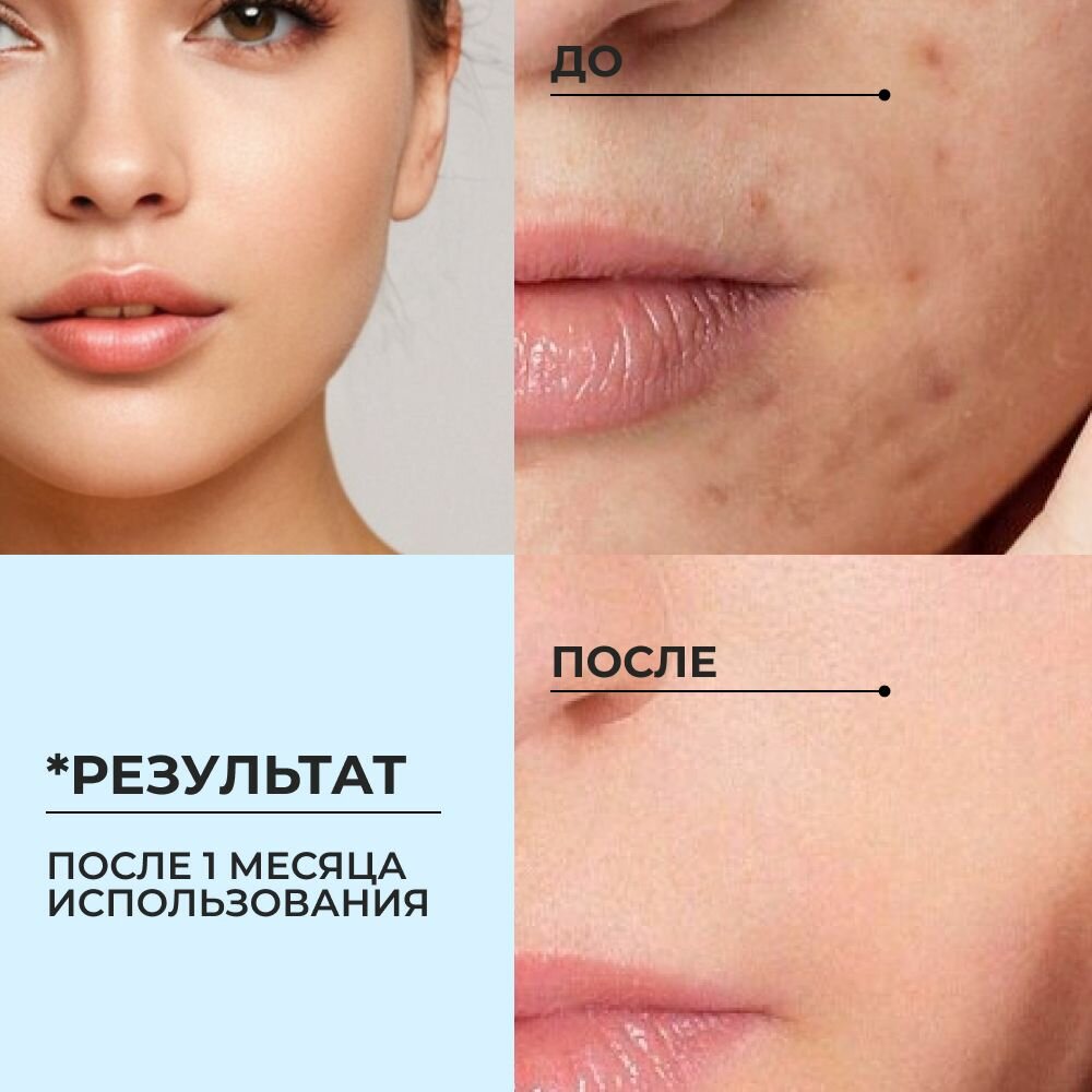 Изображение Гель для умывания очищающий A'pich от прыщей, акне и постакне. Мягкое очищение и увлажнение
