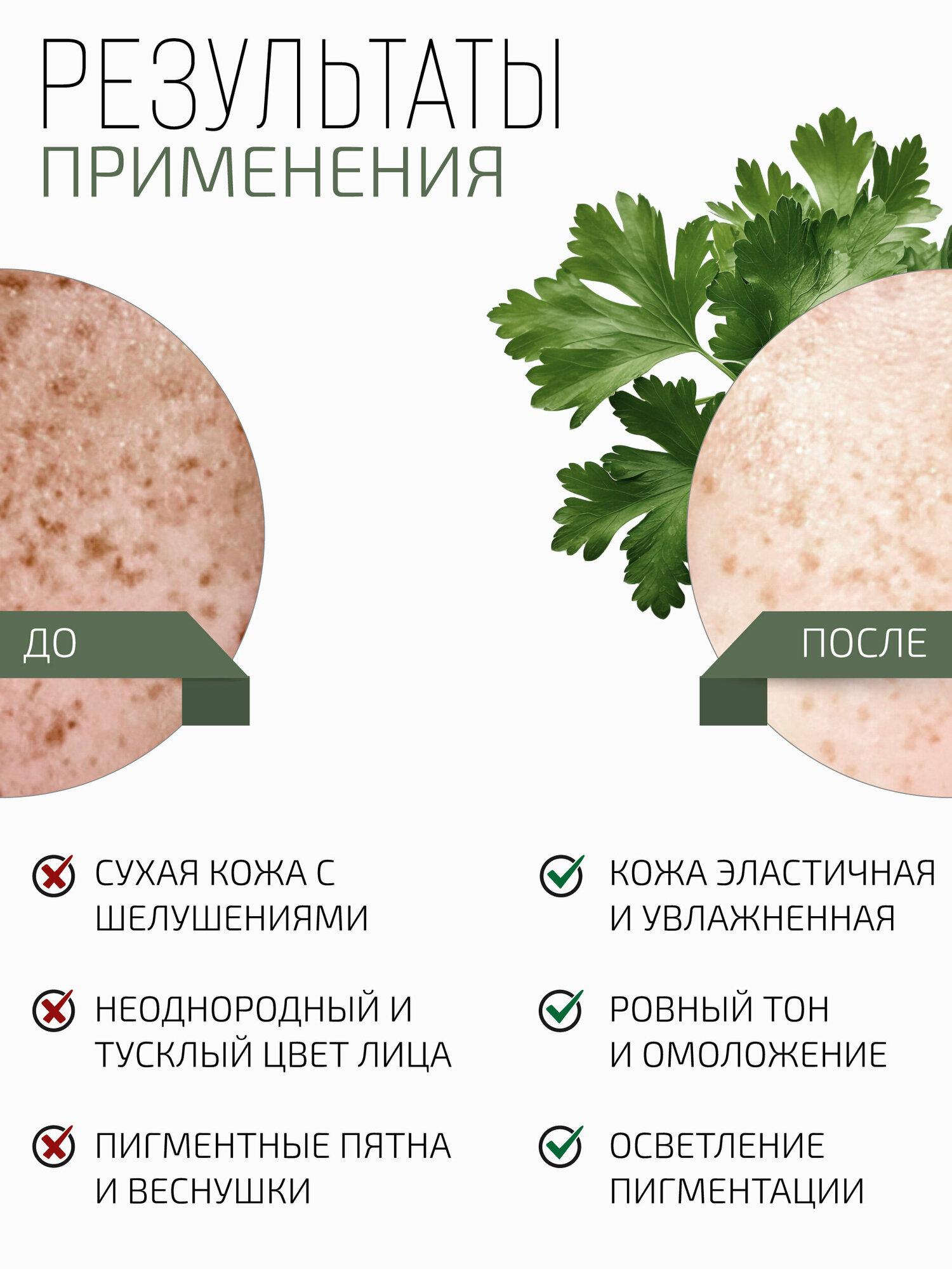 Изображение Ламеллярная осветляющая эмульсия с экстрактом петрушки и койевой кислотой BTpeel, 50мл
