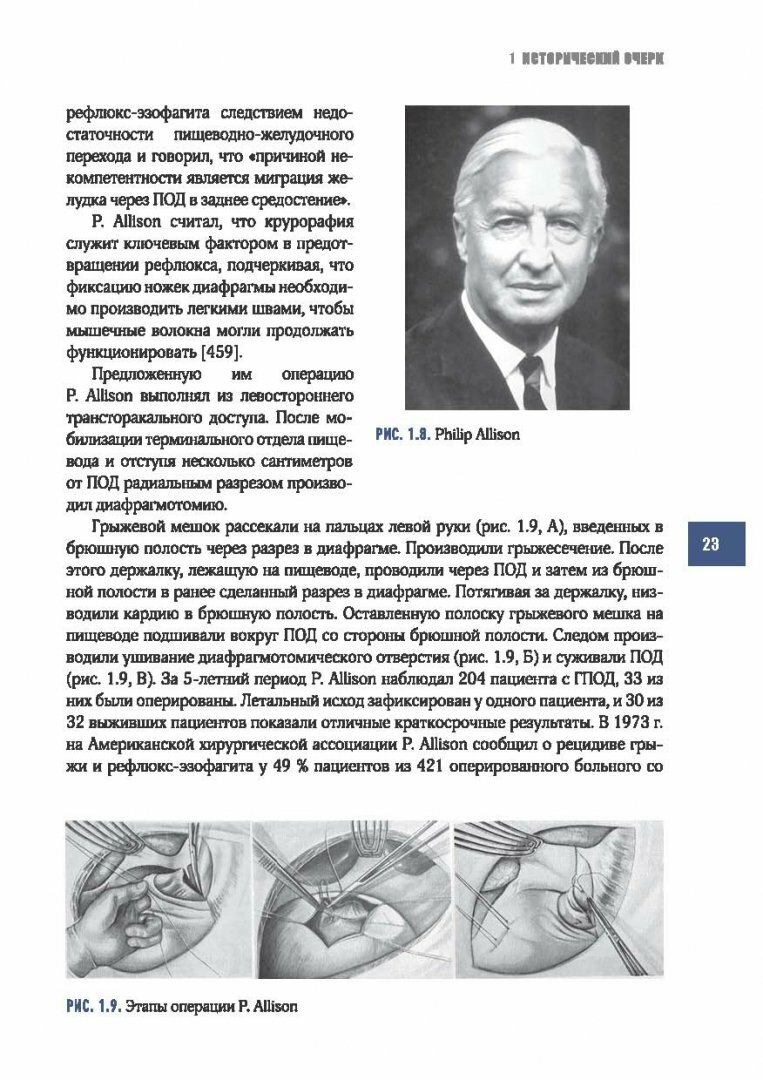 Рефлюкс-эзофагит (Черноусов Александр Федорович, Хоробрых Татьяна Витальевна, Ветшев Федор Петрович) - фото №6