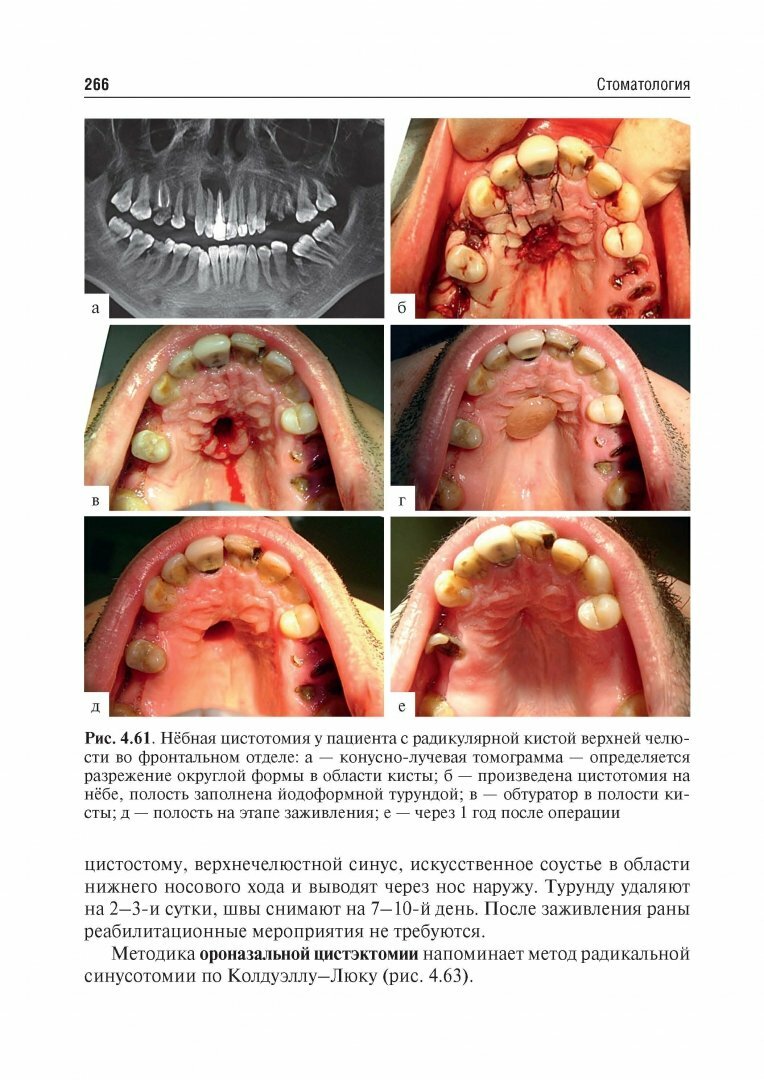Стоматология. Учебник для ВУЗов - фото №16