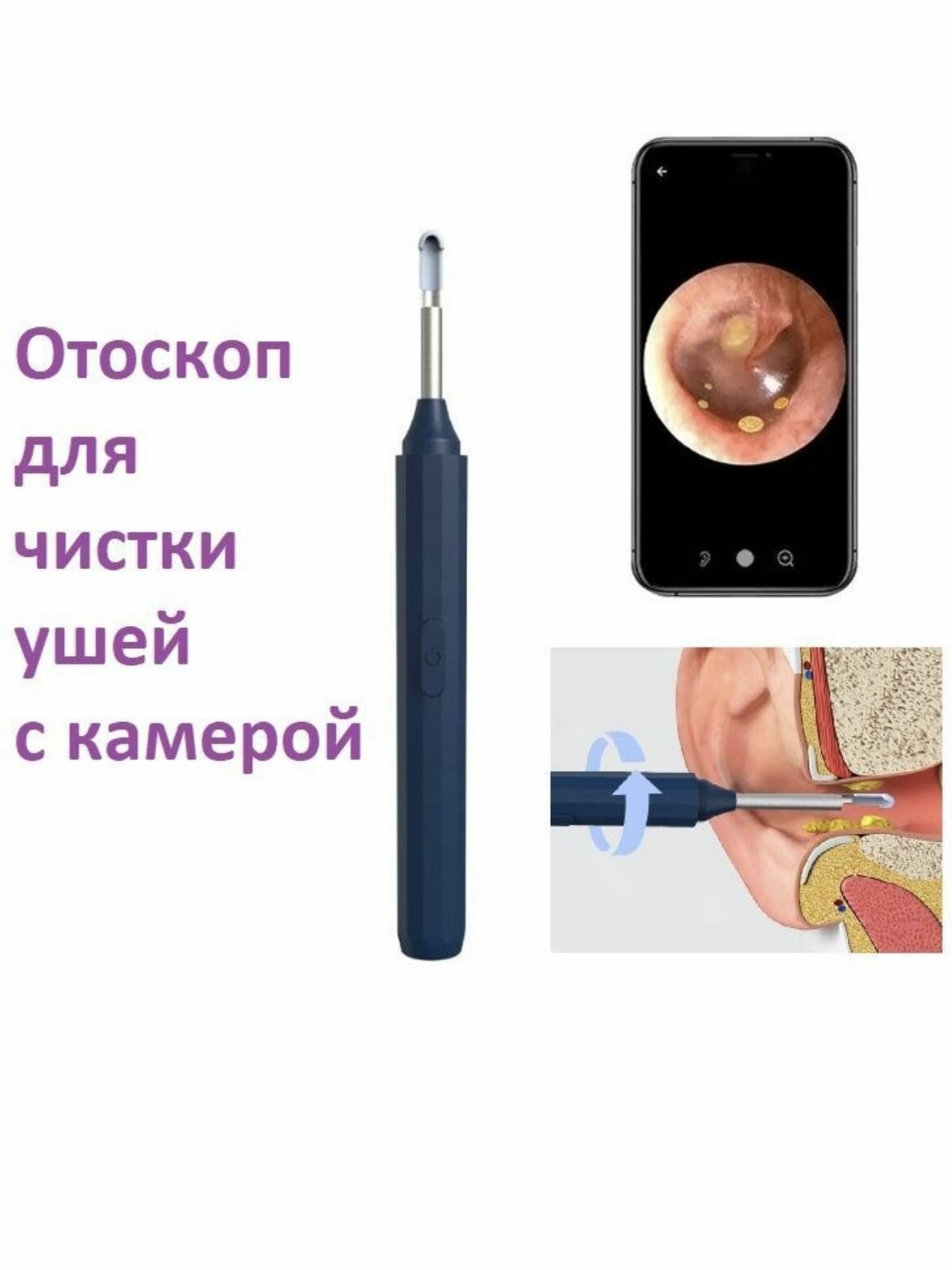 фото Умный портативный отоскоп со встроенной камерой. синий.