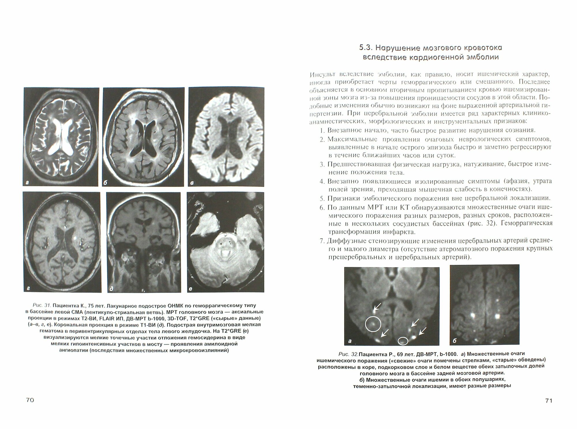 Неотложная клиническая нейрорадиология. Инсульт - фото №2