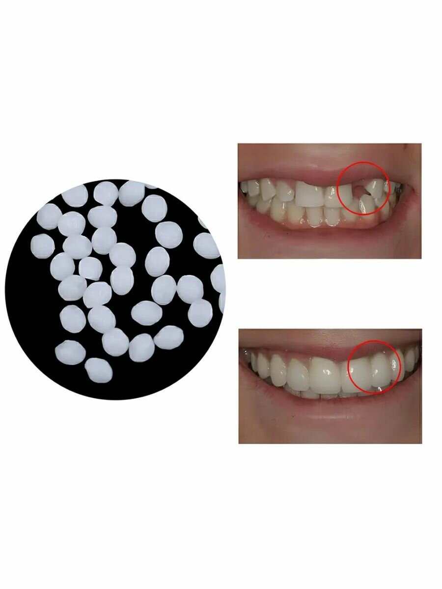 Временный зуб, Материал для создания зуба временный HOMTOPY 50г — фото 1