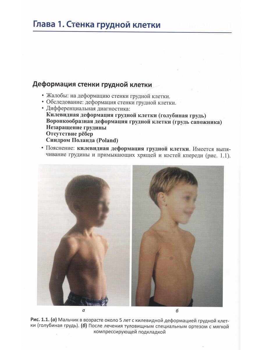 Детская ортопедия Симптомы дифференциальная диагностика дополнительное исследование и лечение - фото №10