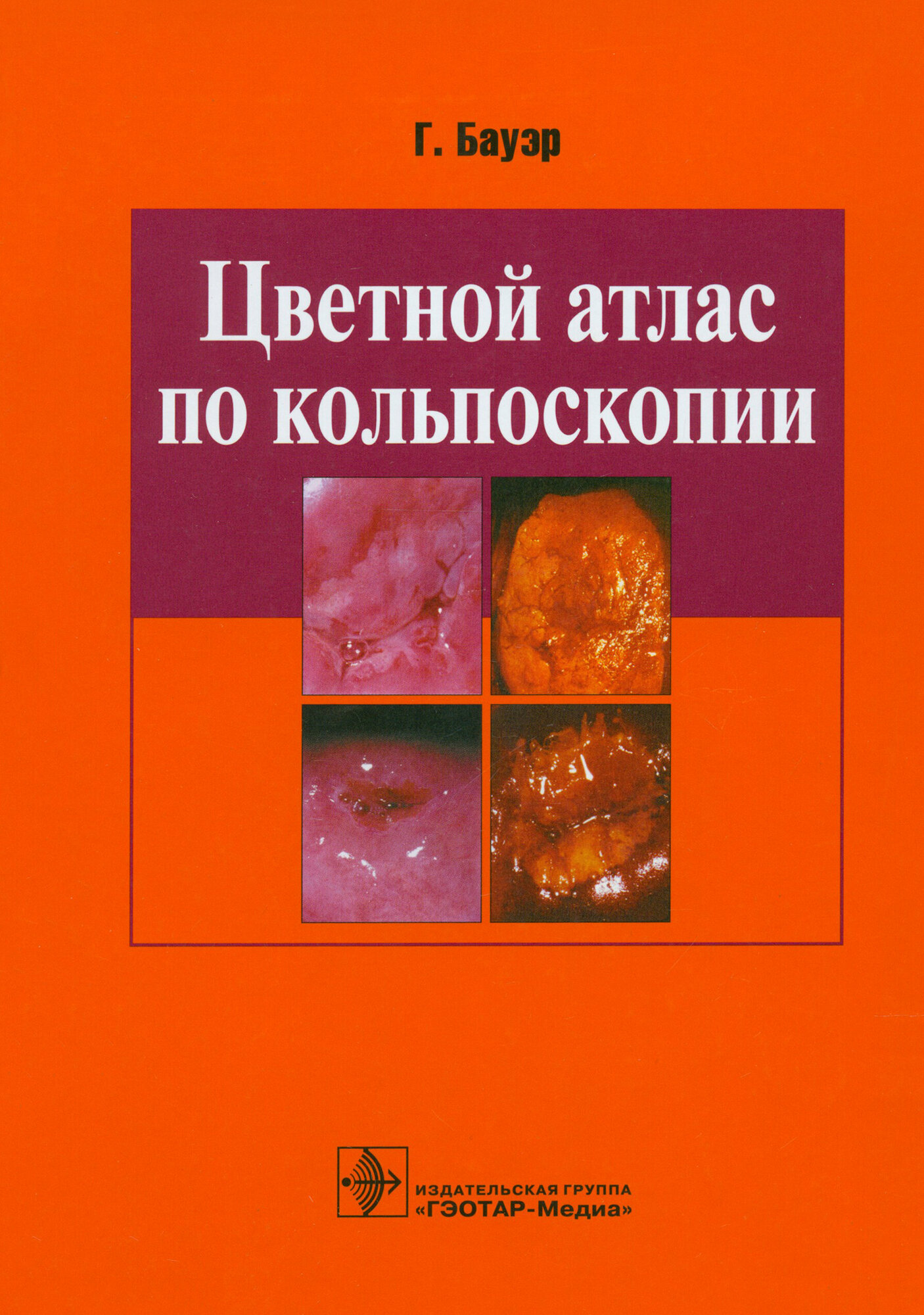 Цветной атлас по кольпоскопии (Бауэр Ганскурт) - фото №12