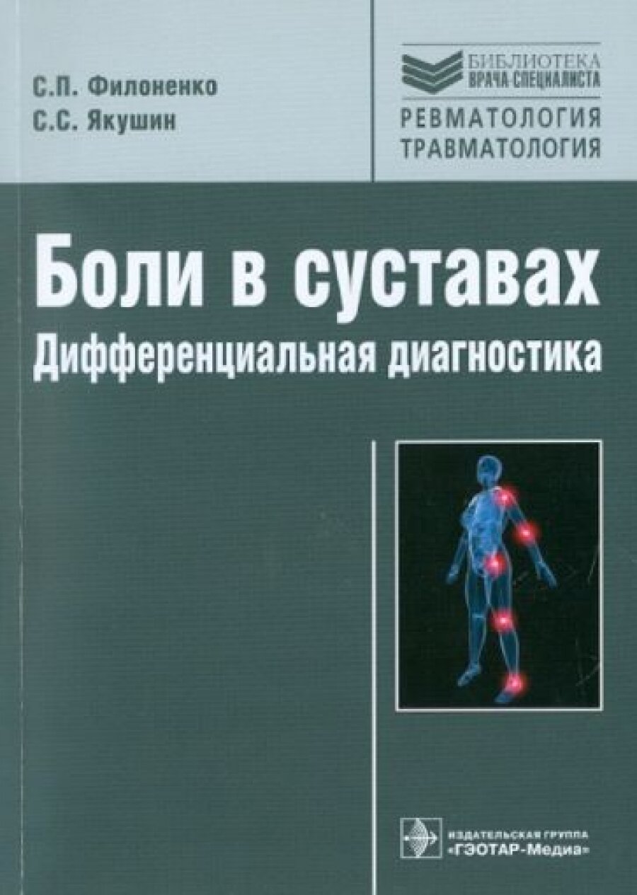 Боли в суставах. Дифференциальная диагностика - фото №2