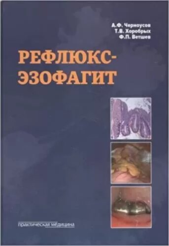 Рефлюкс-эзофагит (Черноусов Александр Федорович, Хоробрых Татьяна Витальевна, Ветшев Федор Петрович) - фото №16