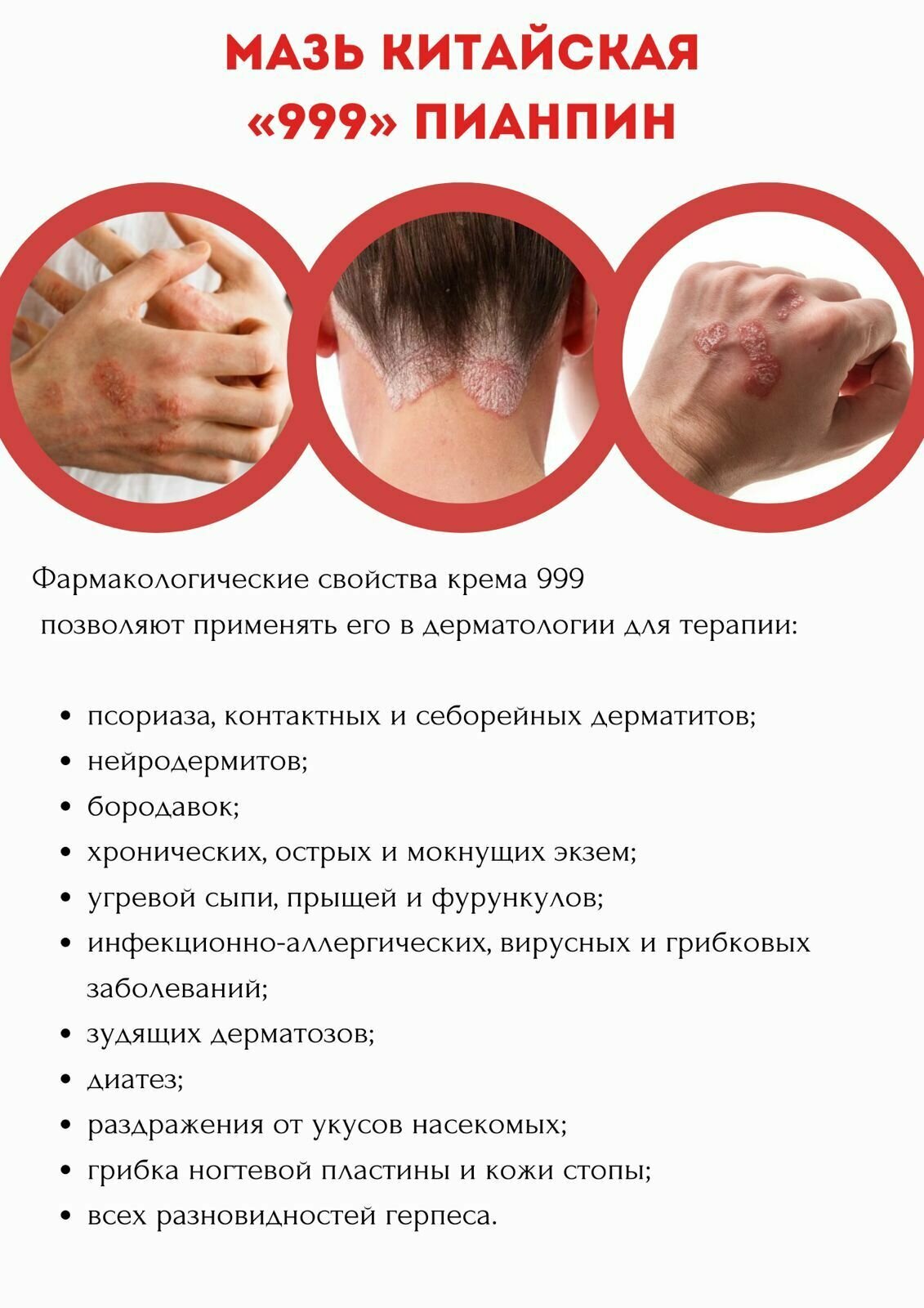 Картинки Китайская антисептическая мазь Пианпин 999 от дерматита / от псориаза