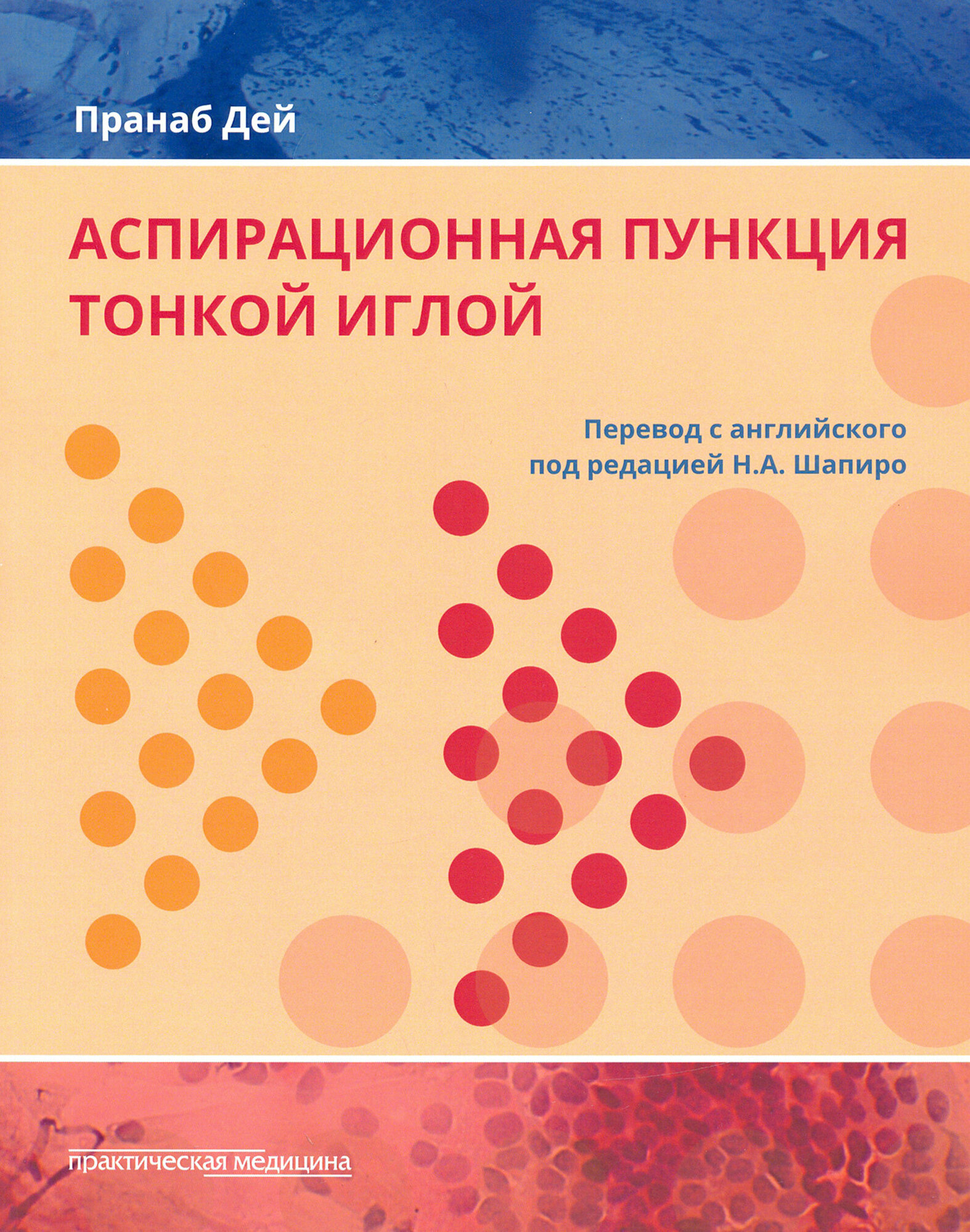 Аспирационная пункция тонкой иглой. Трактовка результатов и диагностические проблемы - фото №16