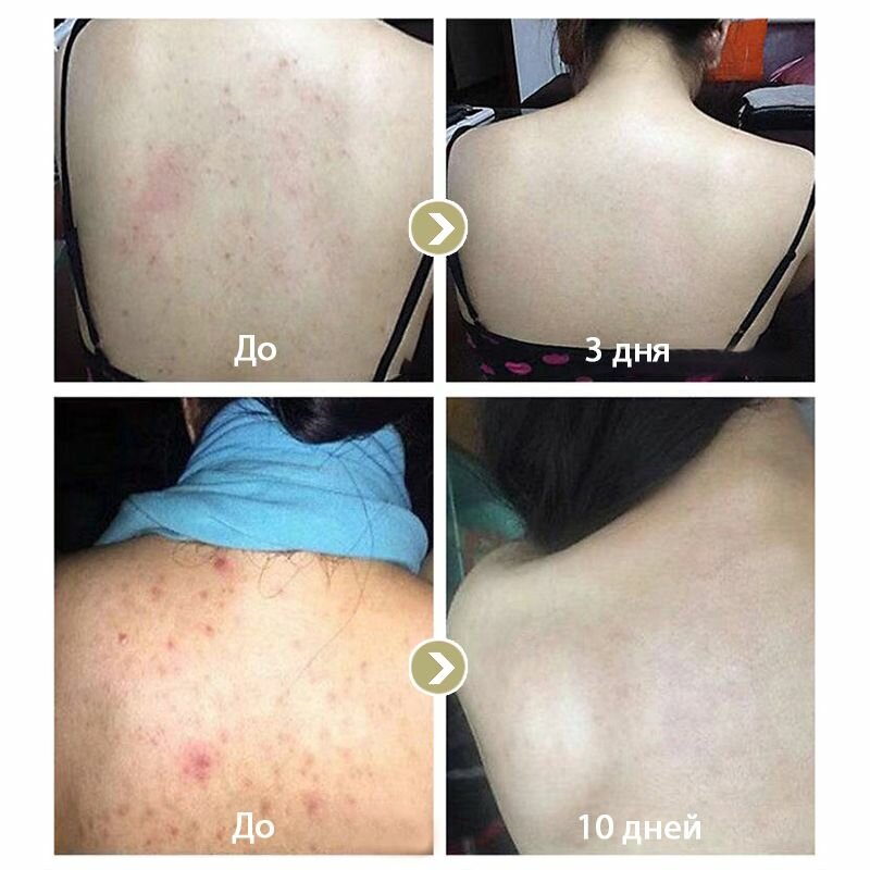 Спрей для ухода за кожей