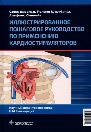 Иллюстрированное пошаговое руководство по применению кардиостимуляторов - фото №2