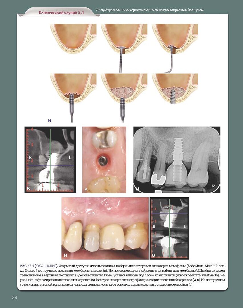 Регенеративные технологии в стоматологии. Научно-практическое руководство - фото №6