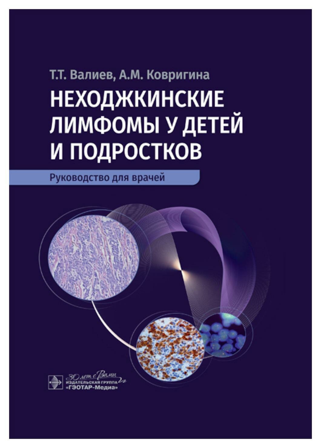 Неходжкинские лимфомы у детей и подростков: руководство для врачей. Ковригина А. М, Валиев Т. Т. гэотар-медиа