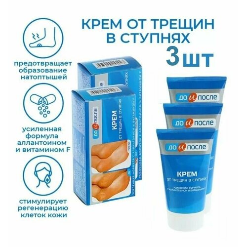 масло минеральное 50 мл 5 шт. Крем от трещин в ступнях До и После, по 50 мл, средство для ног