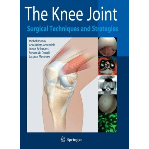 Bonnin, M. et al "The Knee Joint"
