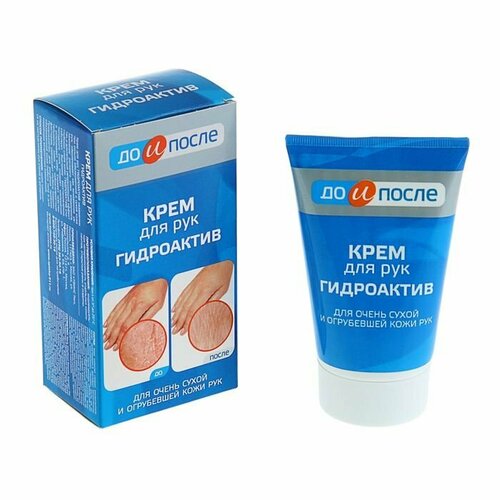 Крем для сухой кожи рук До и После Гидроактив 100 мл комплект из 4 шт 2640₽