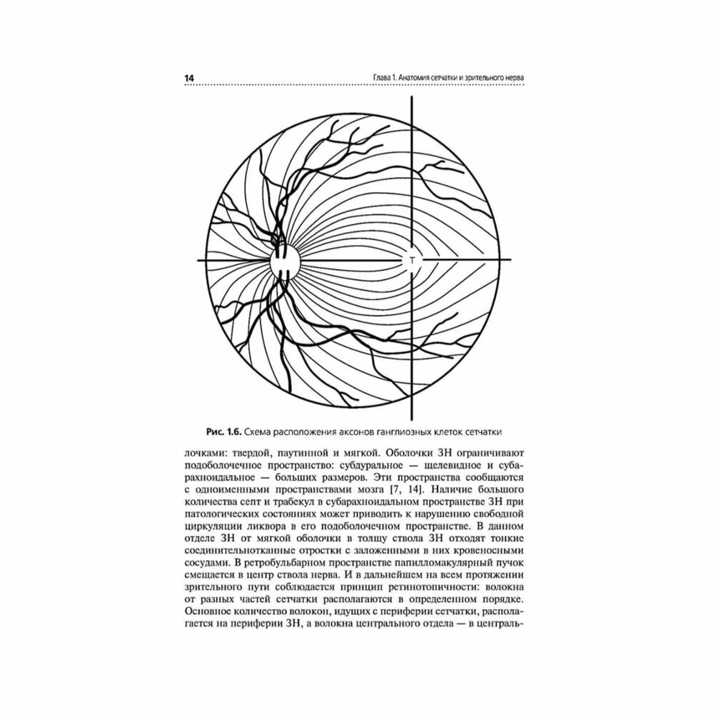 Патология зрительного нерва. Учебное пособие - фото №11