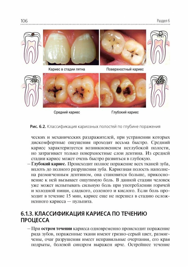 Стоматологические заболевания. Учебник для медицинских училищ и колледжей - фото №7