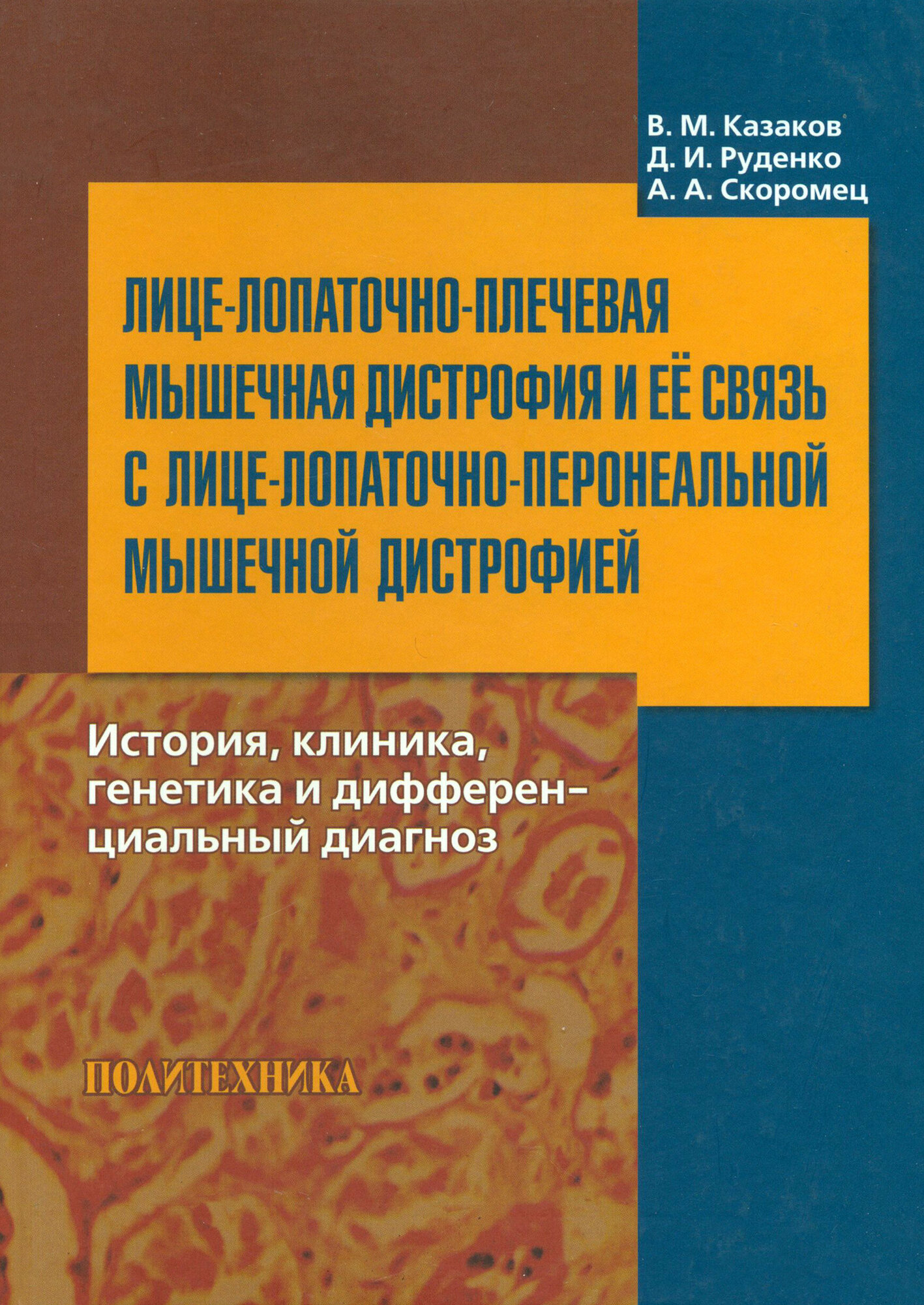 Лице-лопаточно-плечевая мышечная дистрофия