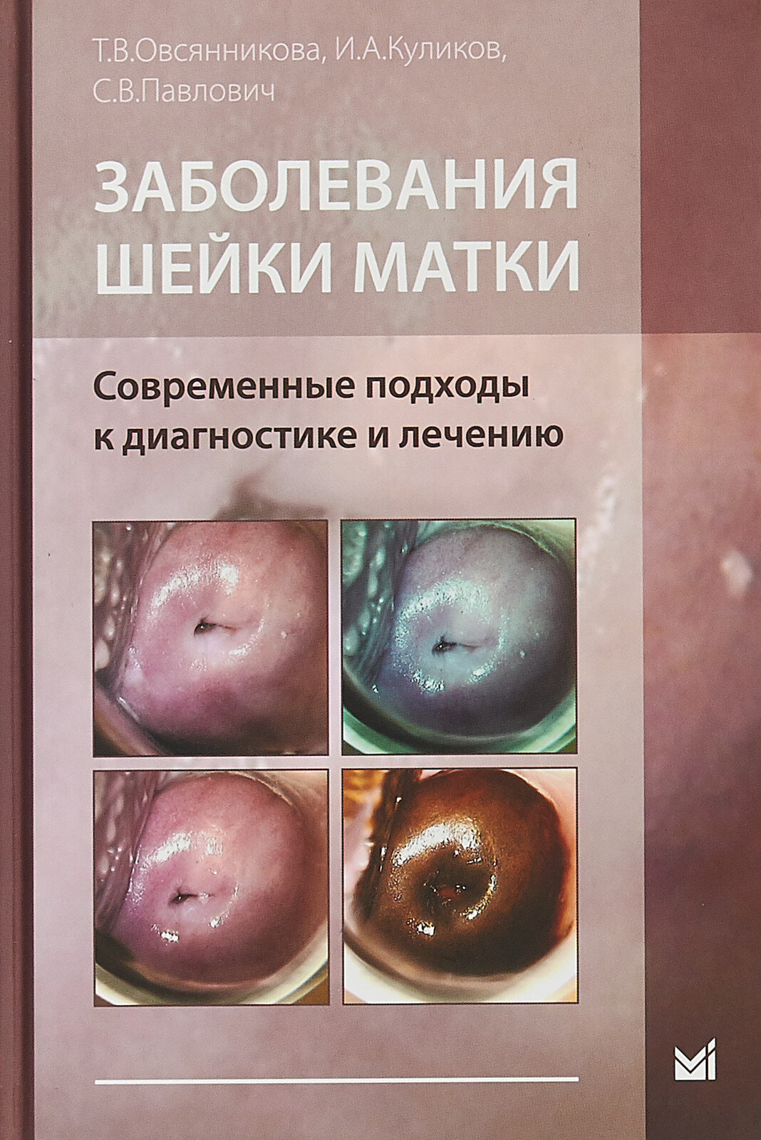 Заболевания шейки матки. Современные подходы к диагностике и лечению. Учебное пособие для врачей