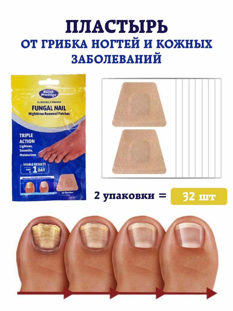 Пластырь от грибка ногтей и кожных заболеваниях