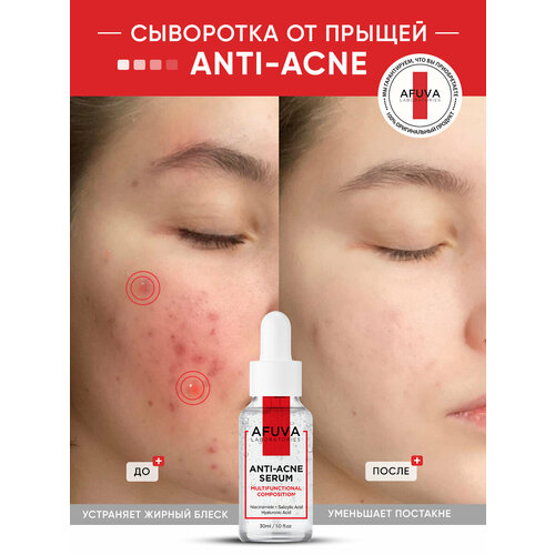 Сыворотка для лица увлажняющая от прыщей и акне и с ниацинамидом , AFUVA, 30 мл