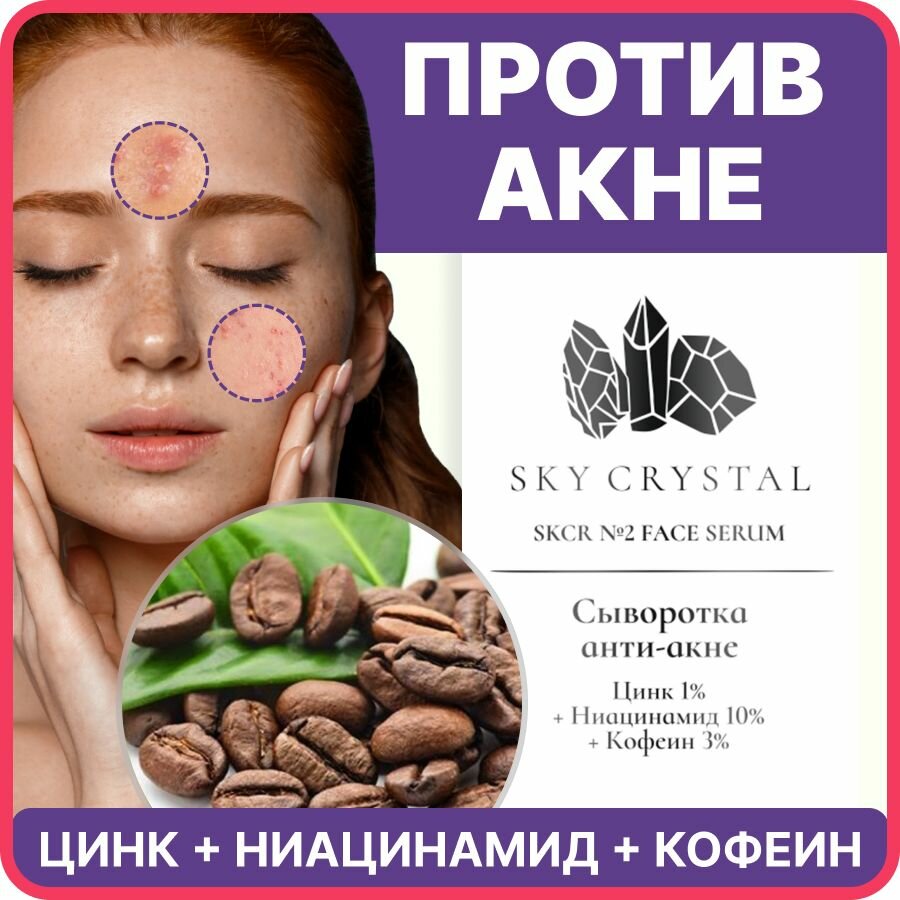 Sky Crystal / Себорегулирующая сыворотка для лица с Ниацинамидом, Цинком против прыщей, акне и черных точек / Увлажняющее уходовое средство для проблемной кожи от пигментации, воспалений и постакне