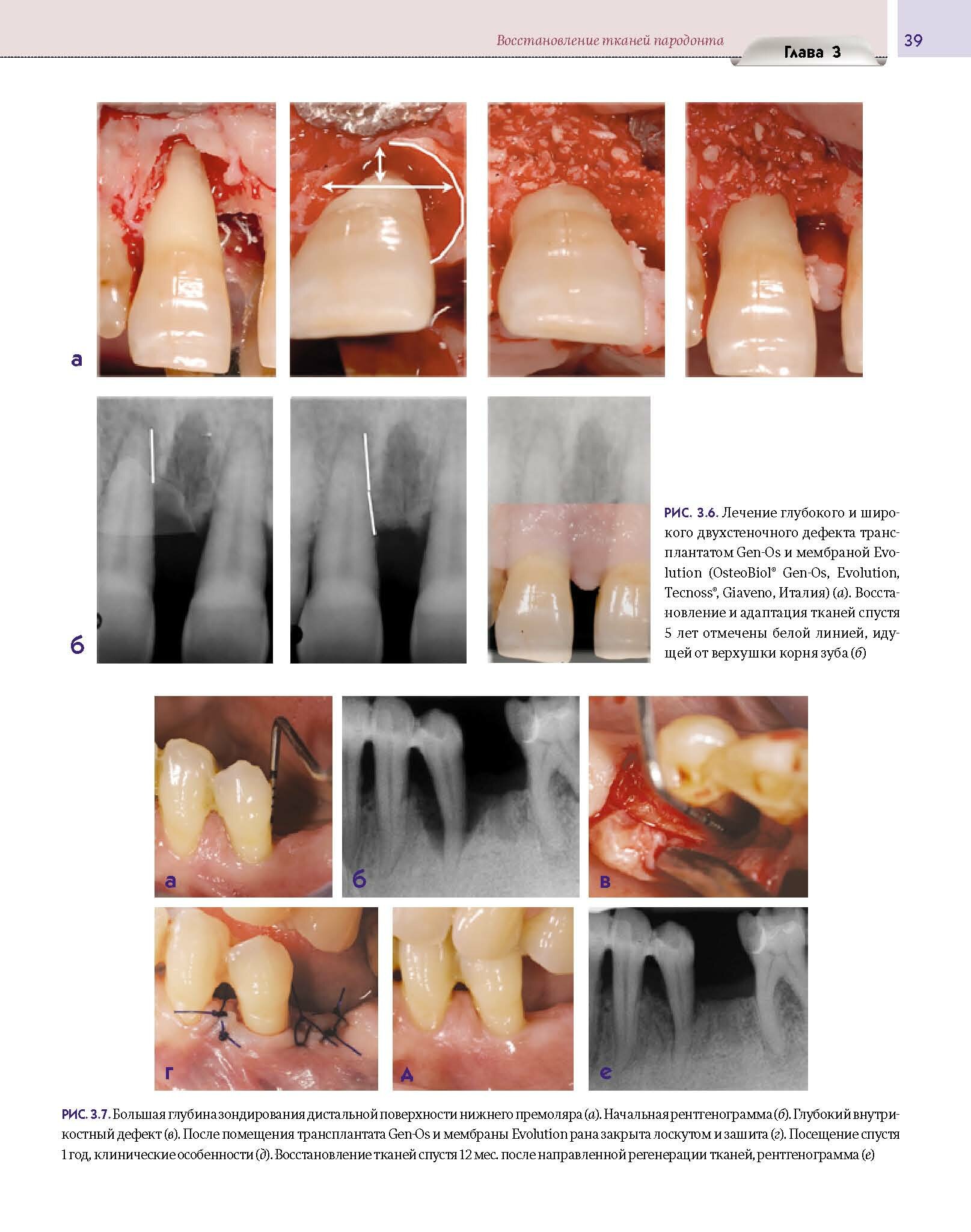 Регенеративные технологии в стоматологии. Научно-практическое руководство - фото №15