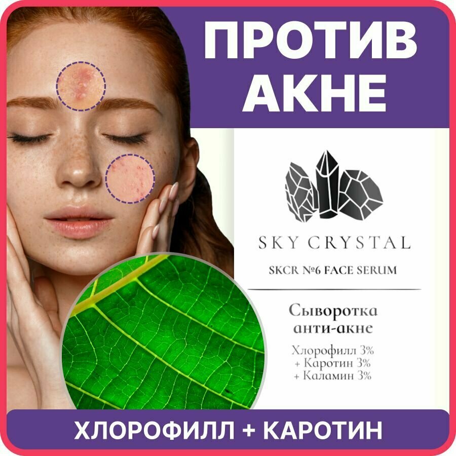 Sky Crystal / Регенерирующая сыворотка для лица с Хлорофиллом и Каротином против прыщей, акне и черных точек / Антисептическое уходовое средство для увлажнения проблемной кожи от воспалений