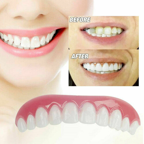 New perfect smile накладные виниры с десной адаптивные 28 шт съемные зубные виниры верхние и нижние зубы