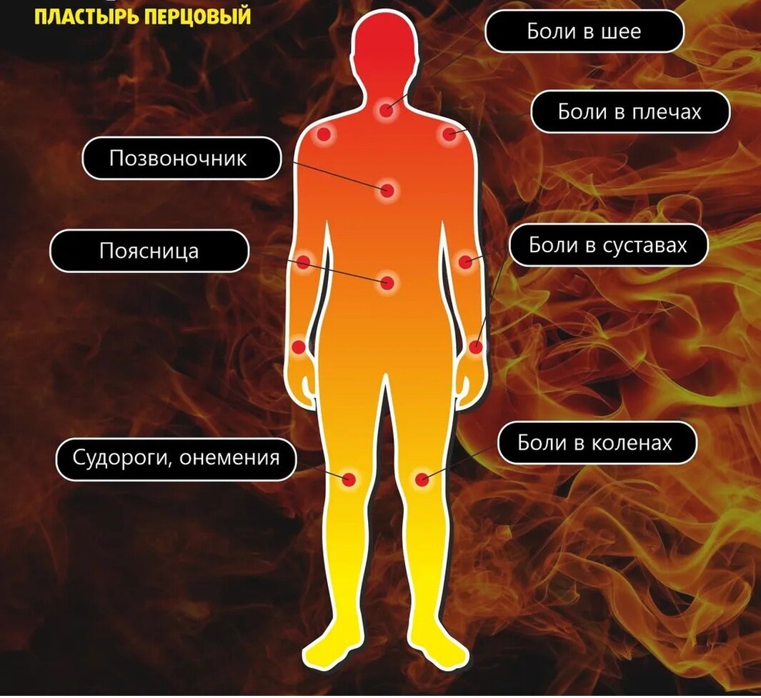 Пластырь "Перцовый" 10х18 мм, набор 10 штуки