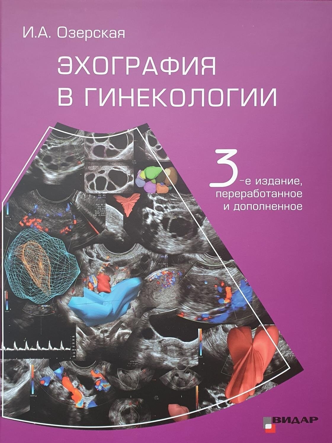 Озерская И. А. "Эхография в гинекологии - 3-е изд, перераб. и доп."