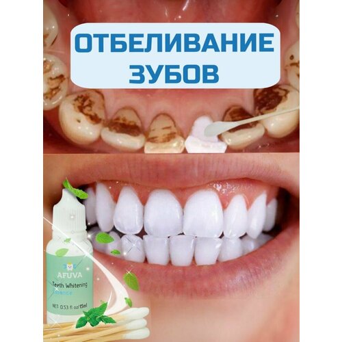 Отбеливание зубов AFUVA, гель для домашнего отбеливания, 15 мл, без переоксида