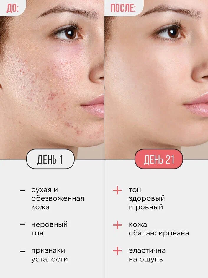 Cosmolex Тоник для лица очищающий с AHA кислотами — фото 1