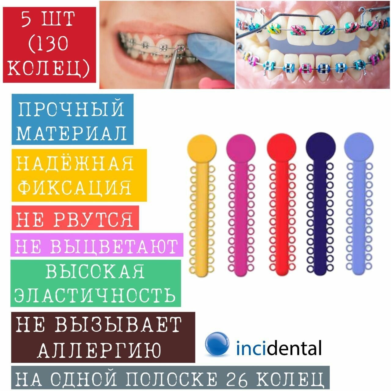 Эластичные ортодонтические Лигатуры Inci LIGATURE TIES // Лигатуры для брекетов 5 шт. ( модуль 130 колец) , цветные . Инсидентал , Incidental .