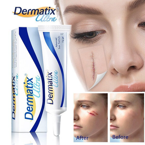 Косметика С Лечебным Эффектом Силиконовый гель Dermatix, для ухода за шрамами и рубцами, 15г.